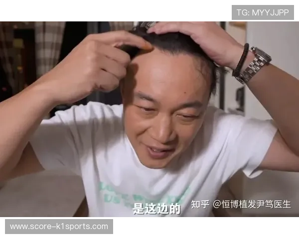 足球球星脱发困扰揭秘 从发际线到球场表现的背后秘密 足球球星脱发困扰揭秘 从发际线到球场表现的背后秘密